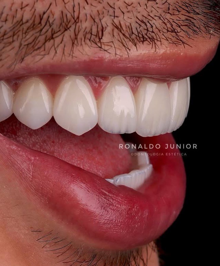 Resultado 2 — Dr. Ronaldo Junior