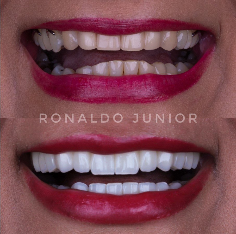 Resultado 3 — Dr. Ronaldo Junior