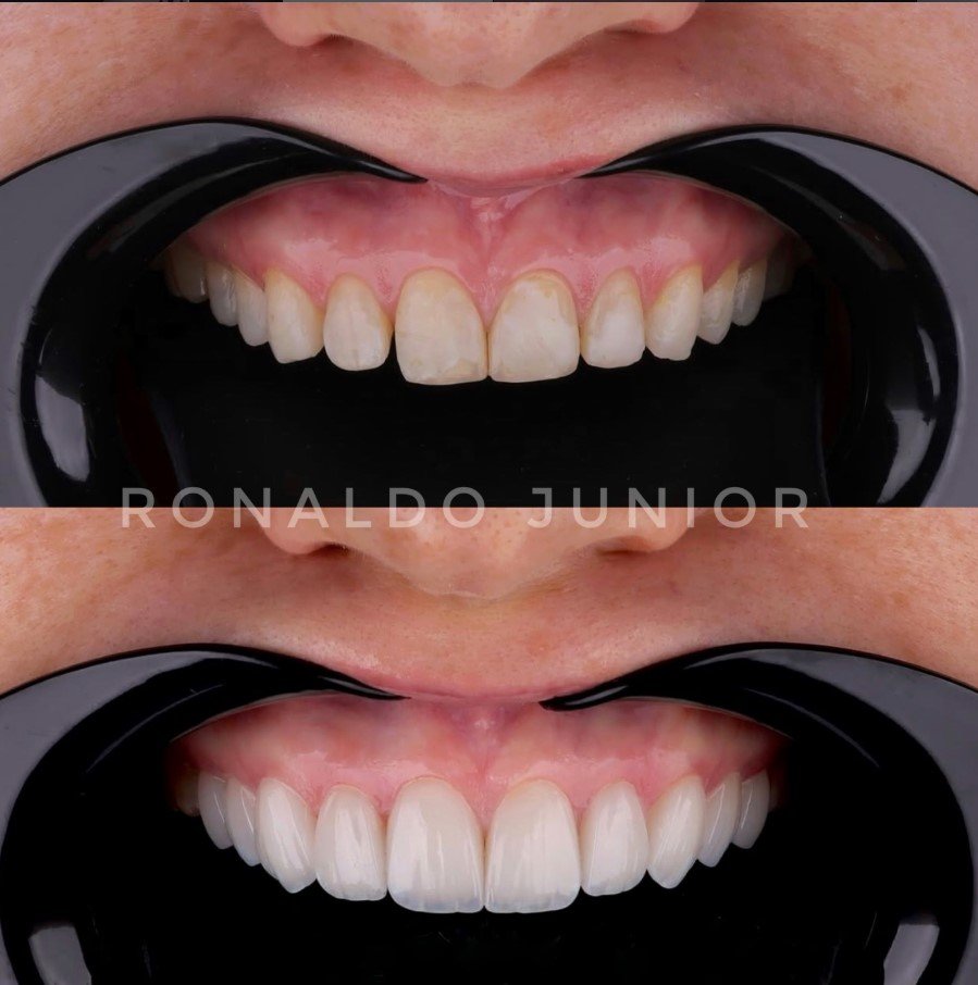 Resultado 4 — Dr. Ronaldo Junior