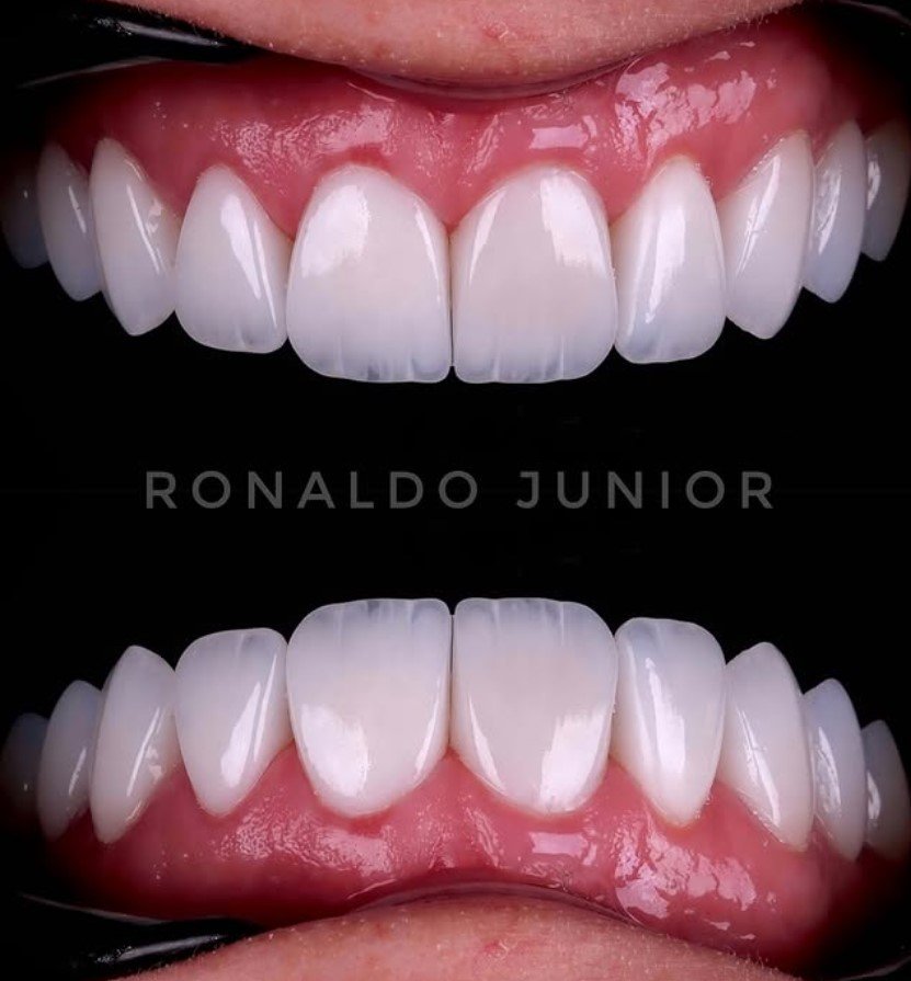 Resultado 5 — Dr. Ronaldo Junior